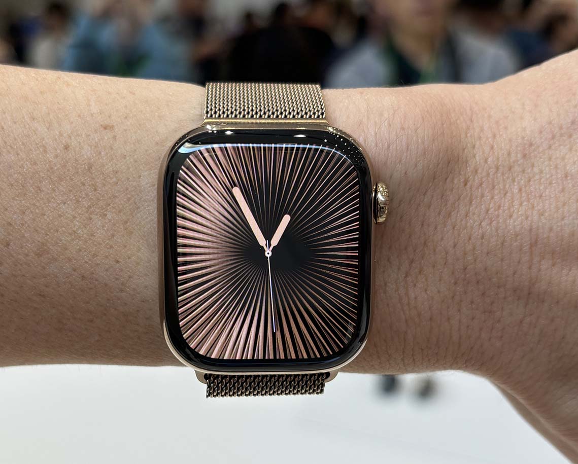 Apple Watch Series 10 auf Zoxs verkaufen: Eine effiziente und zuverlässige Plattform für den Gebrauchtwarenhandel!